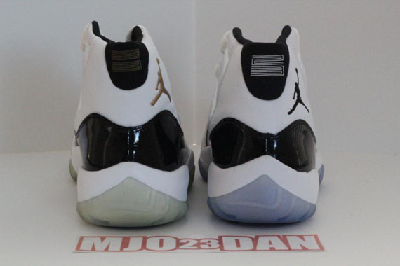 Concord Xi Hist Comparison 25