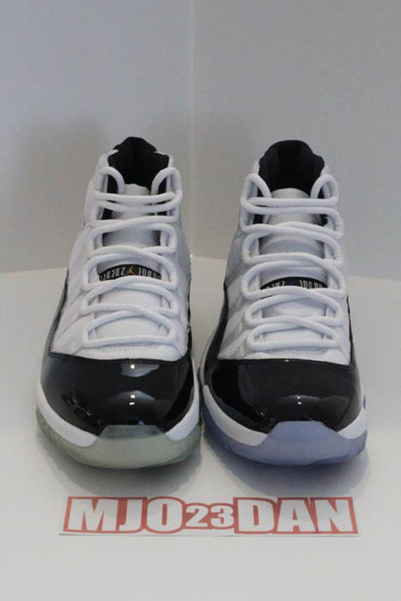 Concord Xi Hist Comparison 26